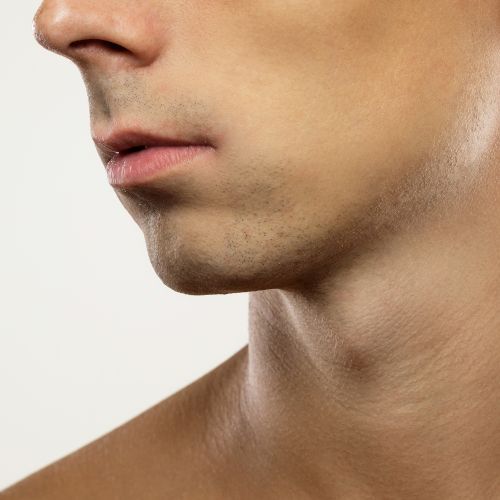 chin and jawline enhancement