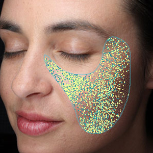 visia skin analysis showing texture